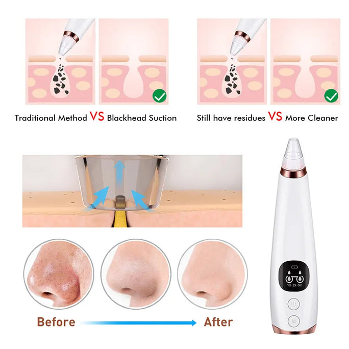 Electric Blackhead Remover Vacuum Acne Cleaner Black Spots Removal Facial Deep Cleansing Pore Cleaner Machine Skin Care Tools